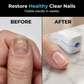 Dispositif portable de soin des ongles à lumière bleue