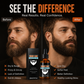 🧔💧 Huile essentielle nourrissante pour le soin de la barbe – hydrate, adoucit et nourrit ! 🌿✨