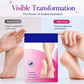 🔥50 % DE RÉDUCTION ! Masque hydratant pour les pieds secs et gercés – Hydratation en profondeur et exfoliation pour une peau douce comme celle d'un bébé ! 🦶✨